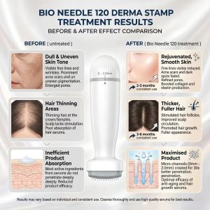 Derma Stamp Bio Needle 120 - Image 3